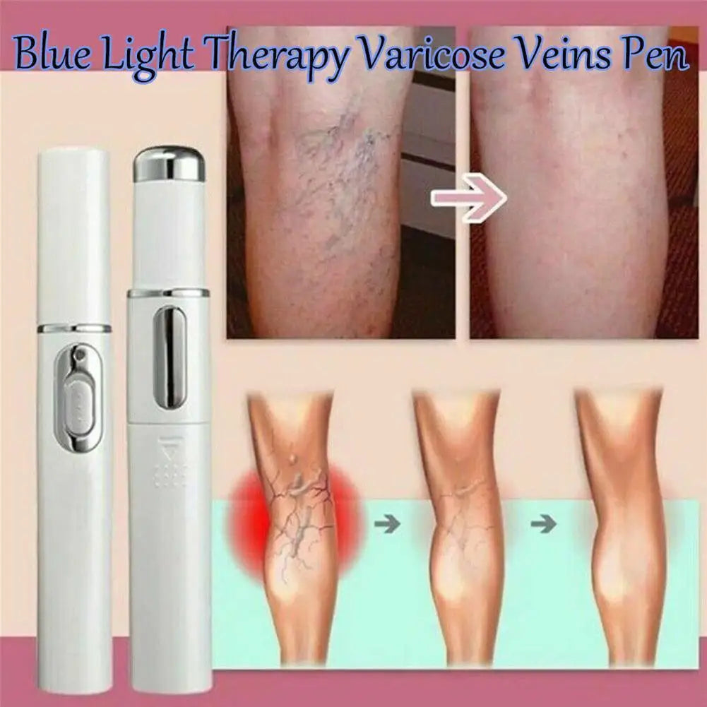 Bolígrafo LED Antiacné de Luz Azul – Terapia Facial para Acné, Cicatrices y Arrugas