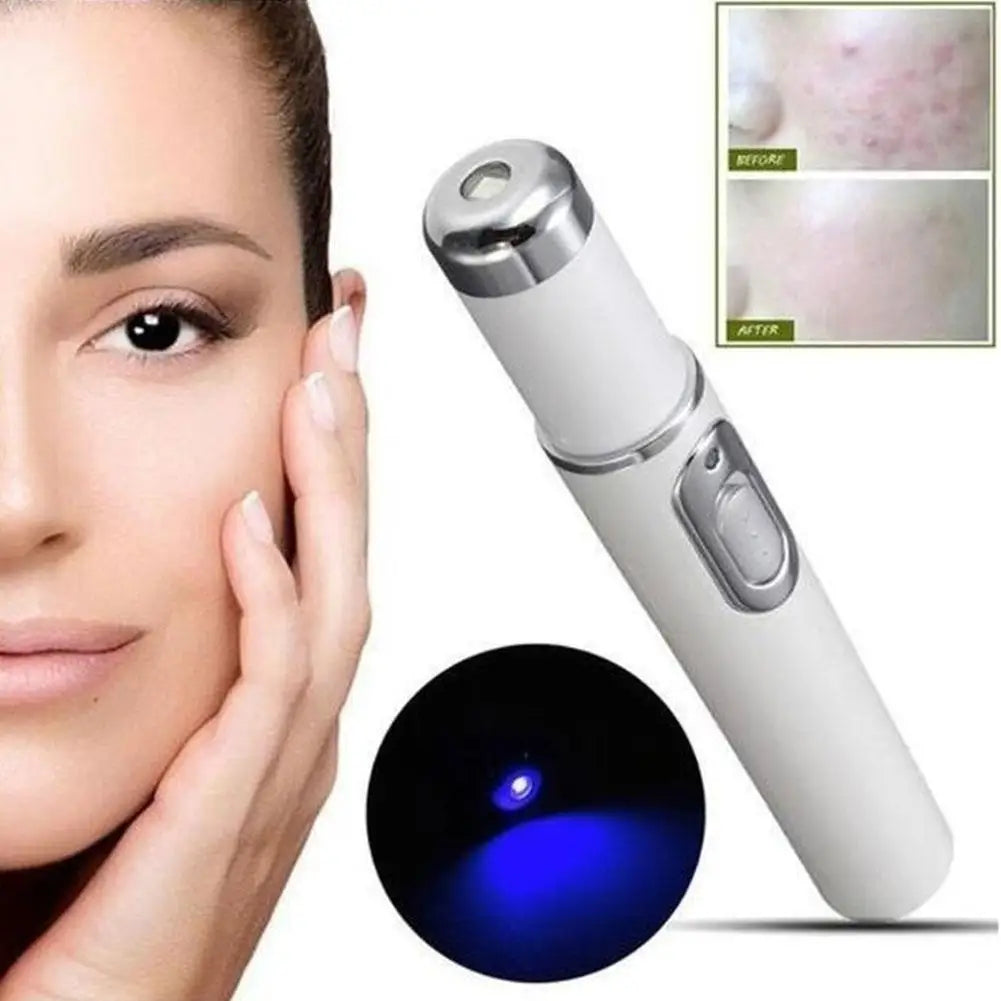 Bolígrafo LED Antiacné de Luz Azul – Terapia Facial para Acné, Cicatrices y Arrugas