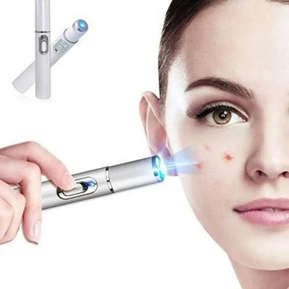 Bolígrafo LED Antiacné de Luz Azul – Terapia Facial para Acné, Cicatrices y Arrugas