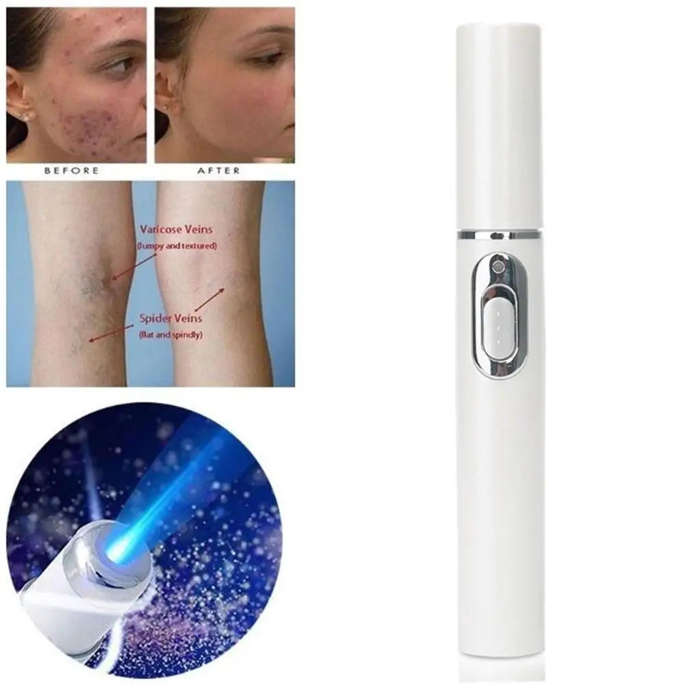 Bolígrafo LED Antiacné de Luz Azul – Terapia Facial para Acné, Cicatrices y Arrugas